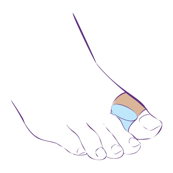 Перегородка межпальцевая Trives СТ-54 с петлей на первый палец 