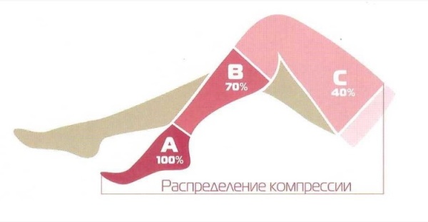 Чулки до бедра I класс компрессии (18-21 мм рт.ст.) ЧС1(п) (ЧЗ)