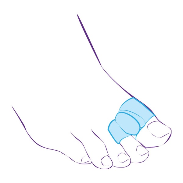 Перегородка межпальцевая Trives СТ-54.2 с петлей на 1-й и 2-й пальцы стопы 